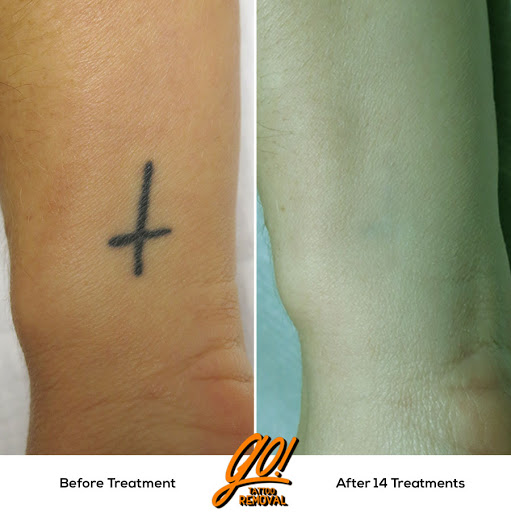 Explore tattoo add on ideas, creative tattoo ideas in Allentown, available at Removery Tattoo Removal & Fading