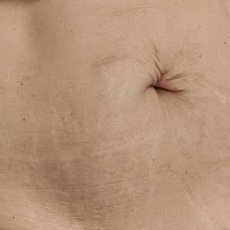 Photo n°12 de Héloïse Soins de Bien-Être à Lourdes ()