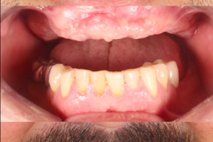 Texas Dental Clinic - implant & cosmetic dentistry image