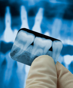 Comentarios y opiniones de RAYDENT Radiografía Dental