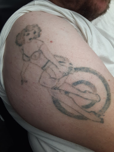 Explore back tattoo placement ideas, creative tattoo ideas in Saint Paul, available at Fearless Tattoo Removal