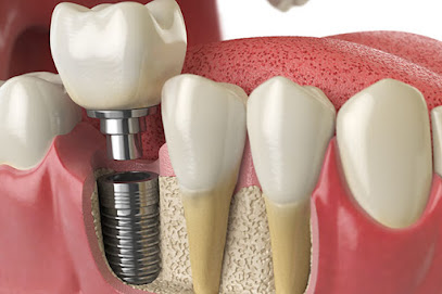Quality Dentures and Implants - Dental Implants & Dentures in Palatka