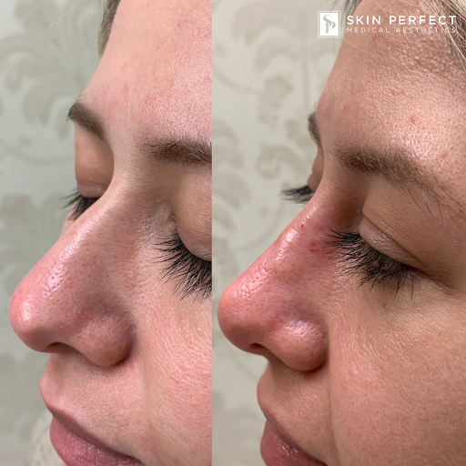 Explore melanie martinez tattoo ideas, creative tattoo ideas in Whittier, available at Skin Perfect Medical Aesthetics