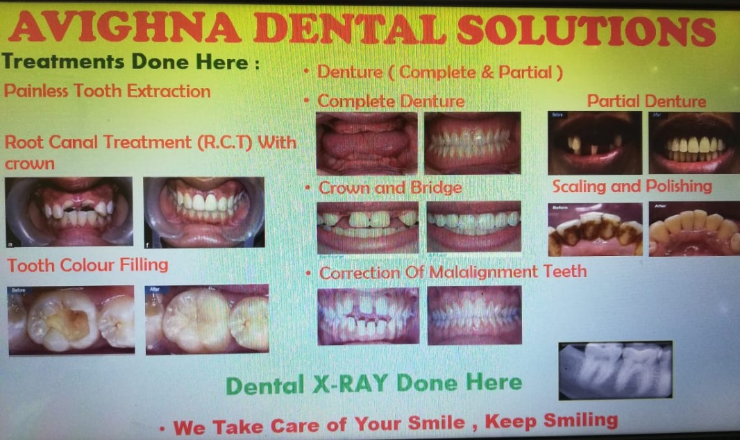 Avighna Dental Solutions