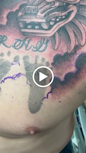 Explore kidney cancer tattoo ideas, creative tattoo ideas in Escondido, available at True style tattoo