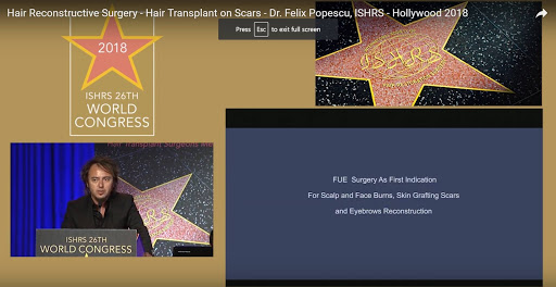 Dr. Felix Hair Implant - Nr. 1 in Transplant de par si Sprancene