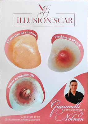 Illusion Scar à Locmiquélic