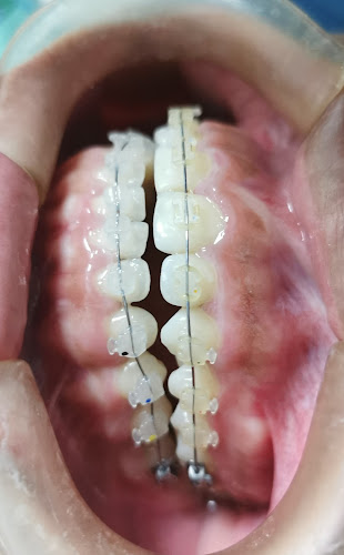 Comentarios y opiniones de My Dentiss Consultorio DENTAL