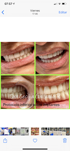 Dental aesthetic course in Guayaquil