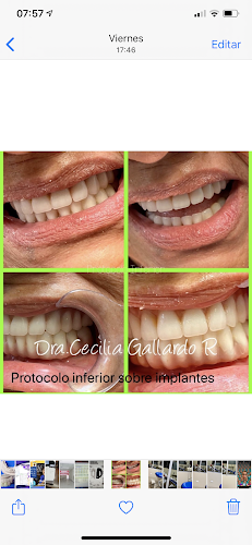 Dra. Cecilia Gallardo Centro De Implantes y Odontológico