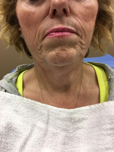 Explore back of head tattoo ideas, creative tattoo ideas in Egg Harbor Township, available at Luxuria Medical Spa & Laser Center Laser Tattoo Removal