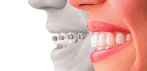 Clinica Dental Duperier en Piedralaves, Ávila‎
