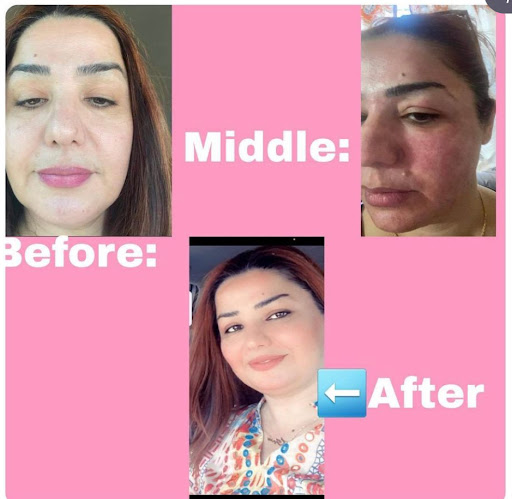 Explore jiraiya tattoo ideas, creative tattoo ideas in Tempe, available at Sparkle Laser HairTattoo Removal