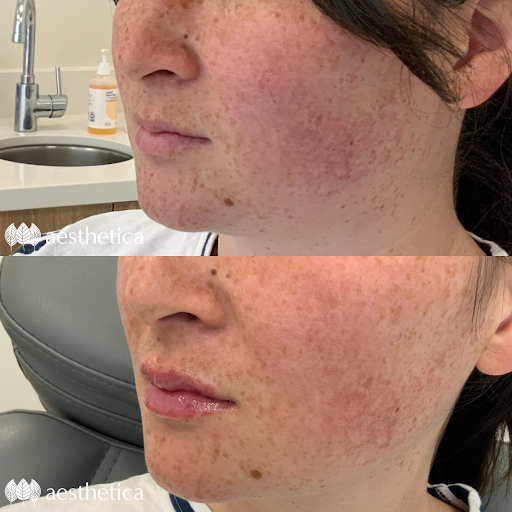 Explore family sleeve tattoo ideas, creative tattoo ideas in Pleasant Grove, available at Aesthetica