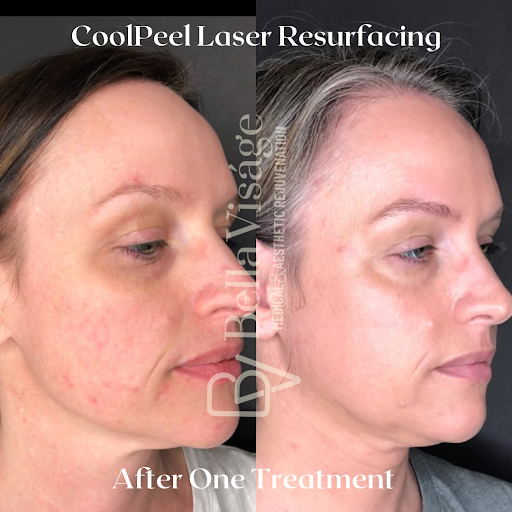 Explore outer forearm tattoo ideas, creative tattoo ideas in Lakeland, available at Bella Visge Medical & Aesthetic Rejuvenation