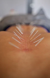 Acuworx Acupuncture Studio - Car repair in Jersey City, NJ, Elizabeth - Rated 5.0/5