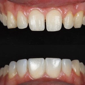 ابتسامة واثقة ممارسة طب الأسنان - شيبرتون - Confident Smile Dental Practice - Shepperton