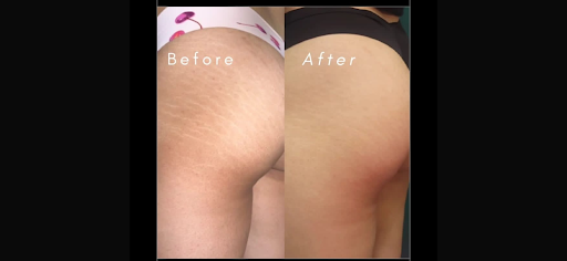 Explore asian tattoo ideas, creative tattoo ideas in Victorville, available at Goawaytats tattoo removal