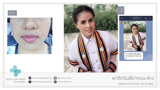 Kowit Cosmetic Surgery Clinic Phuket - Bang Tao - Kowit Cosmetic Surgery Clinic Phuket - Bang Tao