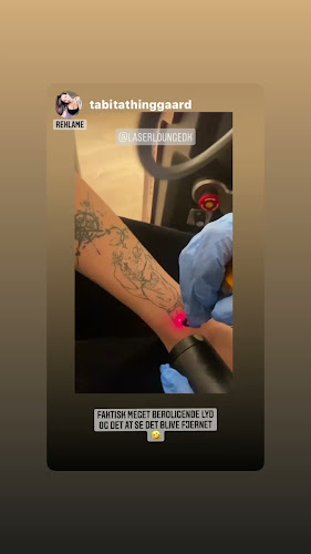 Anmeldelser af Laserlounge-Tattoo fjernelse i Amager Vest - Butik