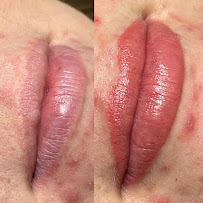 Flawless Glo MedSpa - Photo 5 - Car repair in Grand Junction, CO, Grand Junction