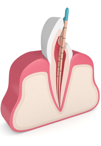 Bellflower Dental Group - Cosmetic and Emergency Dentist Bellflower image