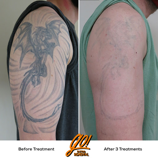 Explore ancient tattoo ideas, creative tattoo ideas in Allentown, available at Removery Tattoo Removal & Fading