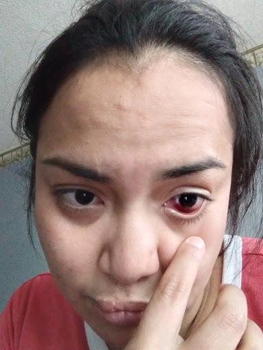 Optometrist «Drs. Stahl & Calder, Optometrists», reviews and photos, 1142 W Redondo Beach Blvd, Gardena, CA 90247, USA