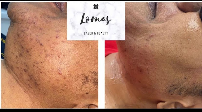 Comments and reviews of Lomas Laser & Beauty - Manchester