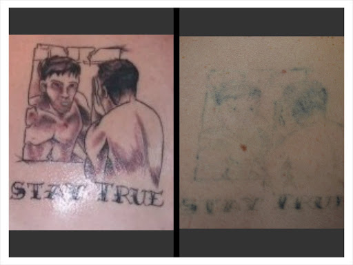 Explore chevy bowtie tattoo ideas, creative tattoo ideas in Colleyville, available at DFW Tattoo Removal