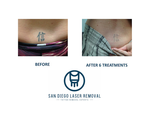 Explore surfing tattoo ideas, creative tattoo ideas in San Diego, available at Removery Tattoo Removal & Fading