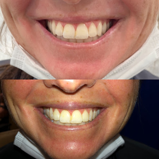 Explore koi fish tattoo ideas, creative tattoo ideas in Owensboro, available at The Skin Lab