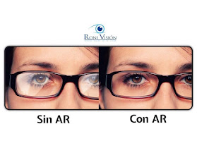 Óptica RONI VISIÓN