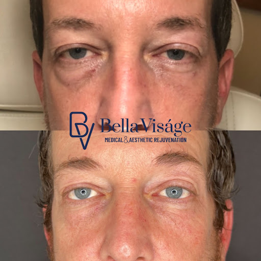 Explore cool tattoo ideas for sisters, creative tattoo ideas in Lakeland, available at Bella Visge Medical & Aesthetic Rejuvenation