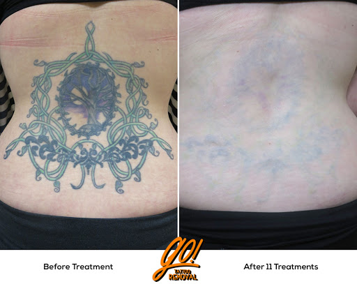 Explore buffalo ny tattoo ideas, creative tattoo ideas in Allentown, available at Removery Tattoo Removal & Fading