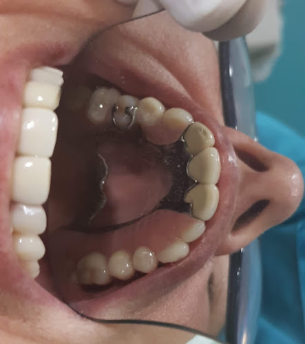 Comentarios y opiniones de Clinica Dental Moretta