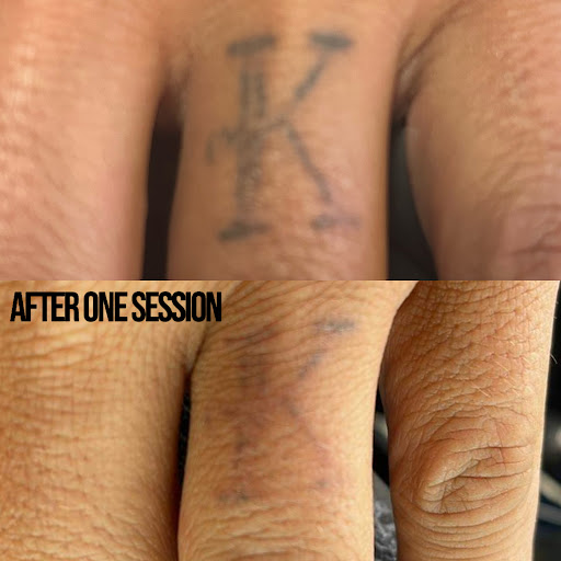 Explore damaged tattoo ideas, creative tattoo ideas in Tucson, available at Lifted Aesthetic Studio LLC