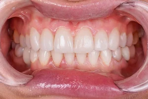 euro.dental image