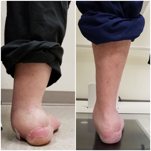 Advanced Foot And Ankle Center Of San Diego: Wrotslavsky Philip DPM