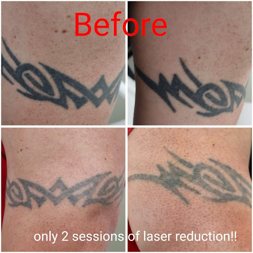 Explore divorce tattoo ideas for women, creative tattoo ideas in Brighton, available at Tip of the Spear Laser Esthetics