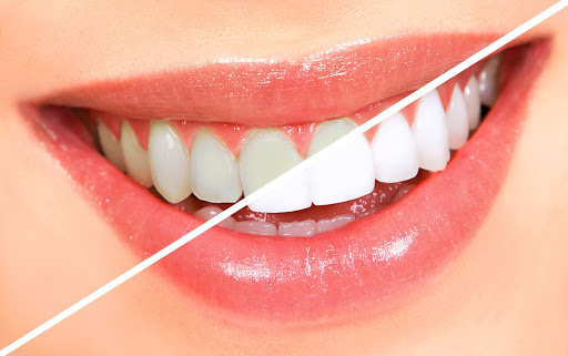 Trillium Smile Dentistry - Mississauga Family Dentist, Invisalign, Teeth Whitening, Dental Implants & More!