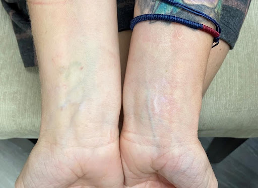 Explore lat long tattoo ideas, creative tattoo ideas in Springfield, available at Under My Skin Tattoo Removal