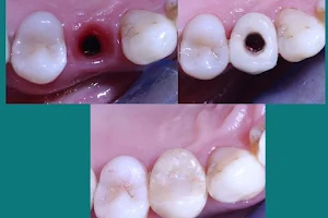 Badr Dental Center (مركز بدر لعلاج وتجميل وزراعة الاسنان) image