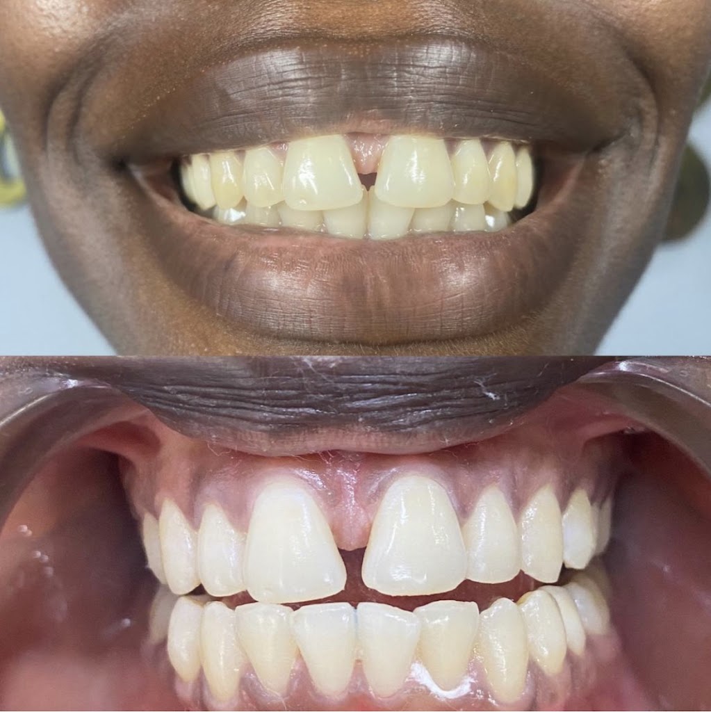 Lash Affects Atlanta 30315