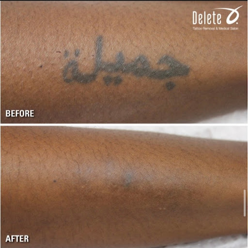 Explore wing tattoo ideas for guys, creative tattoo ideas in Chandler, available at Removery Tattoo Removal & Fading