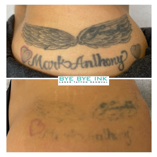 Find cute tattoo ideas for best friends for your next unique tattoo in Middle Village at Bye Bye Ink Laser Tattoo Removal