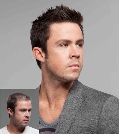 Hair Replacement Service «Elite Solutions Hair Loss Specialists of Sacramento», reviews and photos, 9294 Madison Ave, Orangevale, CA 95662, USA