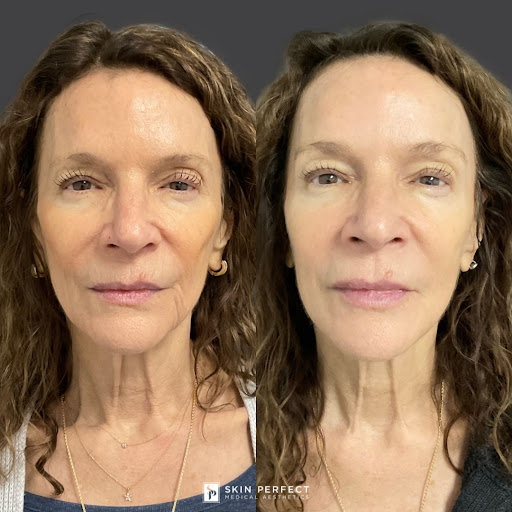 Explore behind neck tattoo ideas, creative tattoo ideas in Whittier, available at Skin Perfect Medical Aesthetics