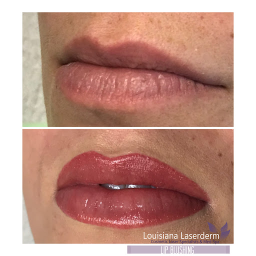 Explore christian chest tattoo ideas, creative tattoo ideas in Baton Rouge, available at Louisiana Laserderm