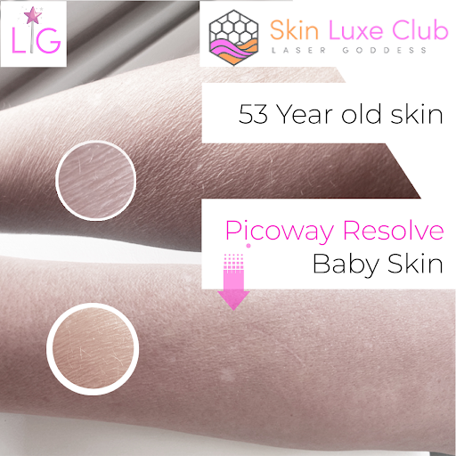 Explore queen crown tattoo ideas, creative tattoo ideas in Bayside, available at Laser Goddess